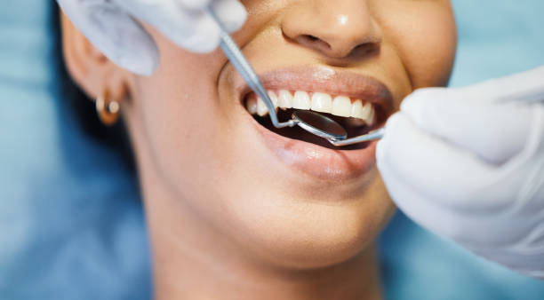 Best Emergency Wisdom Teeth Removal in Kingsville, MD